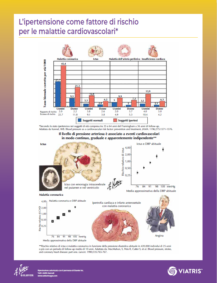 3B Scientific Poster Ipertensione – Formato 50x67 Cm – Carta Fotografica 200g – Didattica Medica