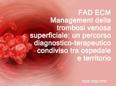 FAD ECM – Management della trombosi venosa superficiale