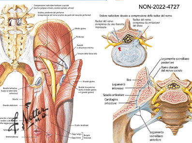 Tavole Netter in area Dolore
