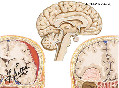 Tavole Netter in area CNS