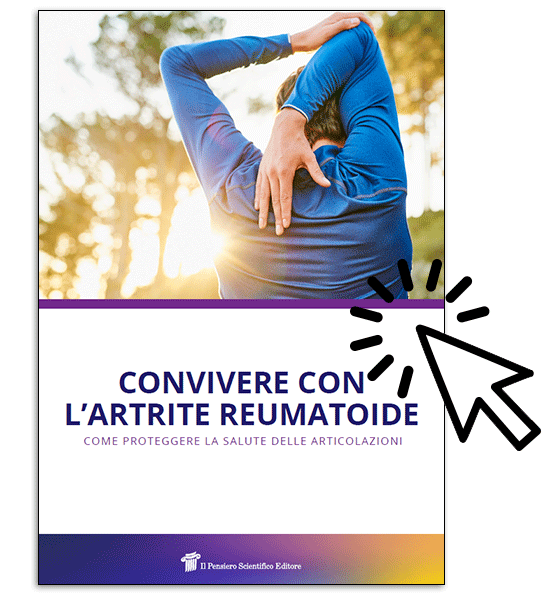 convivere artrite reumatoide