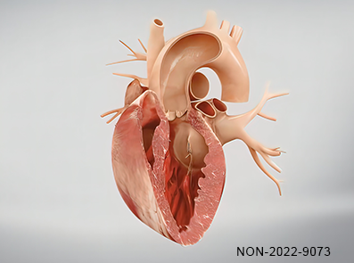 ARITMIA: Tachicardie sopraventricolari