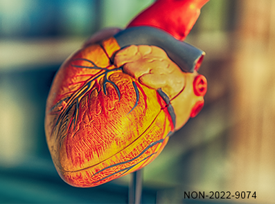 Diabete e rischio cardiovascolare