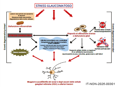 CARD patogenesi glaucoma